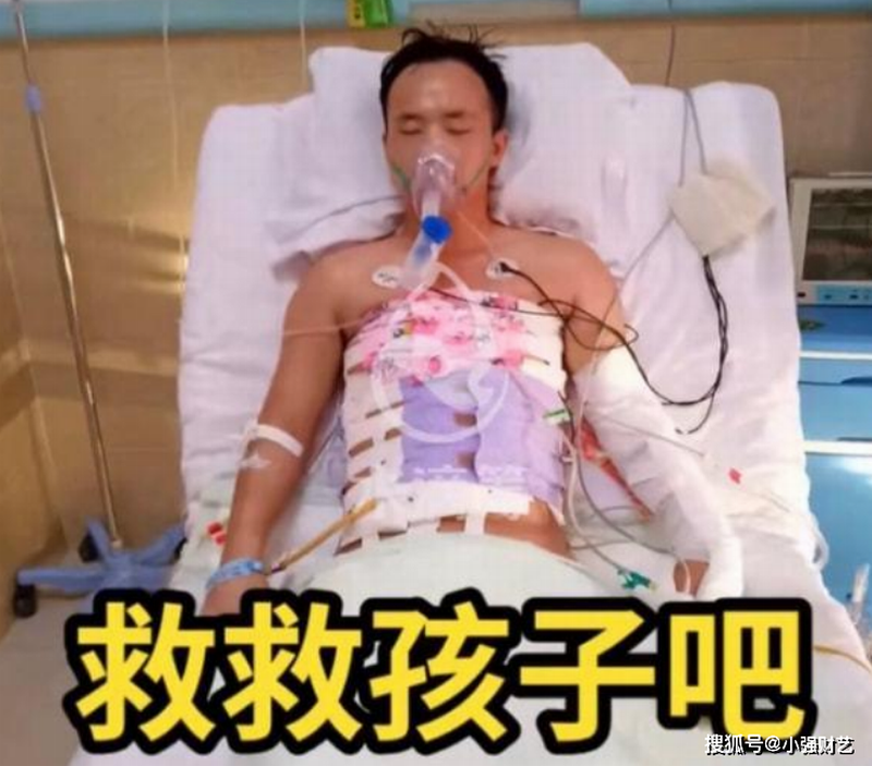 网红“草原公主”哥哥的一张近照，他全身包满了绷带，戴着呼吸机躺在病床上.png