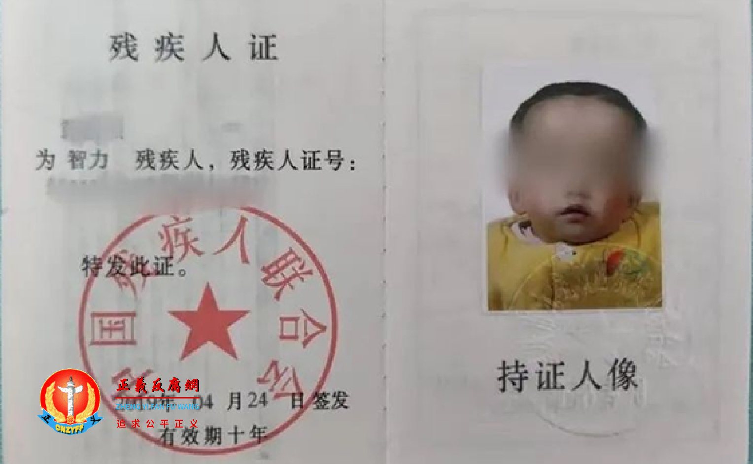 重庆居民黄先生的女儿被鉴定为智力二级残疾.png