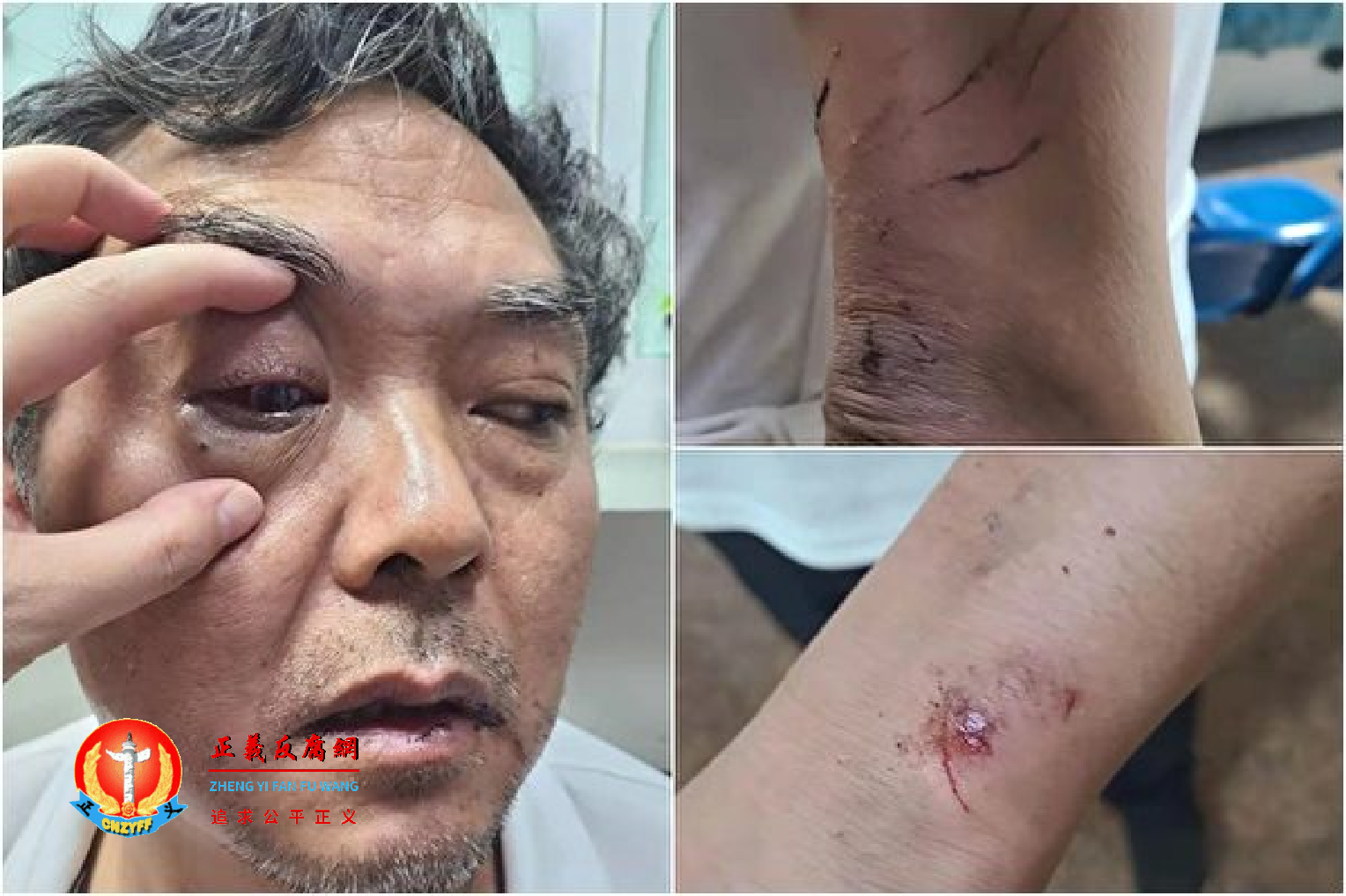 4月19日晚上9时许，维权律师陈科云在位于广州天河区龙洞林机厂小区散步时，突然遭到数名不明身份男子围殴，致全身多处受伤。.png