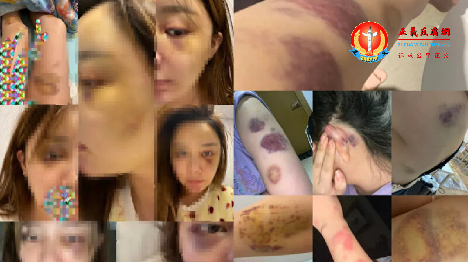 爆料女性小雅po出遭雷姓男子长期殴打的照片.png